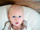 新生儿头上有个软包多久能下去 怎样保护小宝宝不摔伤