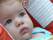 宝宝脑炎的症状是什么 宝宝脑炎怎么办