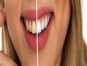 骨性龅牙整牙前后对比 骨性龅牙到底有没有治疗的必要