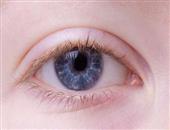 干眼症引起眼睑痉挛的治疗方法 缓解干眼症的方法