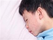 小孩急性肠胃炎怎么办 小孩急性肠胃炎的症状是什么