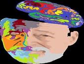 老人脑萎缩头疼怎么调养 西医治疗脑萎缩的常规方法