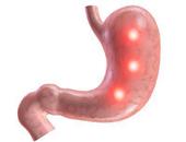 胃癌手术胃漏应该怎么办 胃癌手术胃漏的日常护理