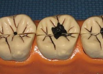 1杯姜水摆脱身体10种不适