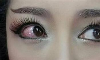 青光眼的主要症状会有哪些呢