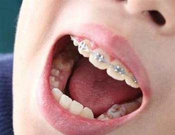 智齿导致的口腔溃疡怎么办
