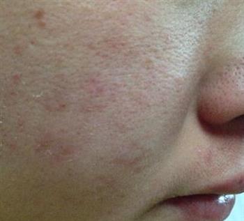 薏米DIY告别粗大毛孔和黯沉肤色