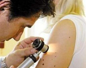 夏季常食绿叶蔬菜可预防皮肤癌