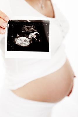 怀孕胎儿水肿怎么回事 教你几招轻松预防胎儿水肿