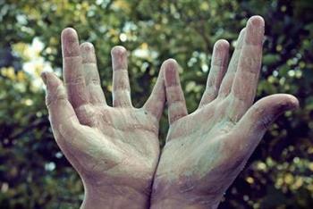 手癣用过的东西 会导致什么症状