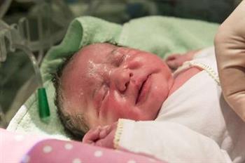 新生儿用碘伏的注意事项有哪些 新生儿湿疹可以不可以用碘伏