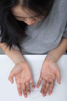 男人有遗传性脱发要如何防脱 防脱发的8个小妙招告诉你