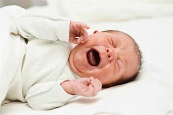 新生儿黄疸正常值 有黄疸严重吗