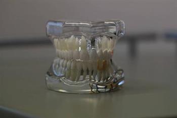 补牙牙套的作用 补牙有什么材料
