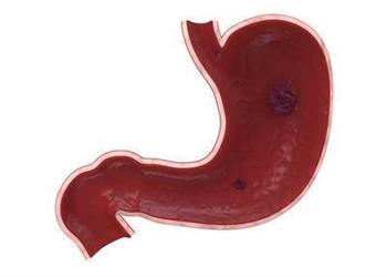 慢性胃炎能吃益生菌吗 慢性胃炎要检查什么