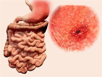 尿毒症双肾衰竭饮食技巧都是什么 尿毒症双肾衰竭的检查指标