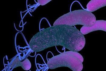 艾滋病女性患者应注意一些什么 艾滋病的主要症状有那些