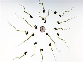 精子发黄怎么回事 精子健康的判断标准