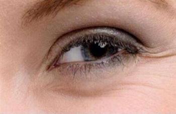 食物疗法去除鱼尾纹四妙招