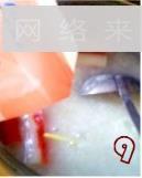 鳝骨海鲜粥的做法图解9