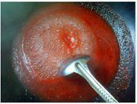 红果家茄汁杏鲍菇的做法图解4